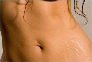 7d0d25bfcaa1421c2931a4f0387462aa_L